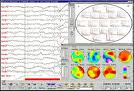 EEG és EKG vizsgálatokkal kimutatható a földsugárzások hatása az emberben